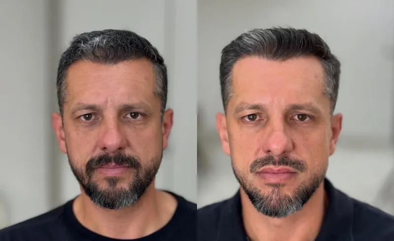 Antes e depois de corte e barba masculina - visagismo em Curitiba