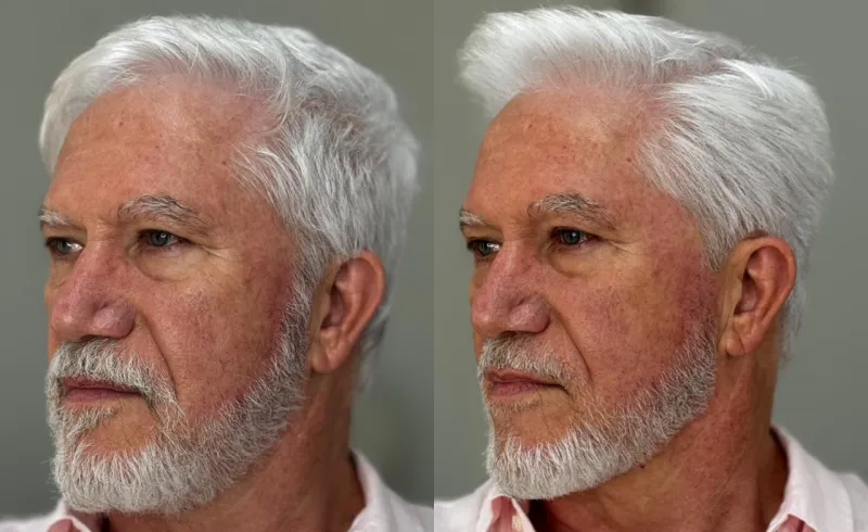 Resultado de visagismo masculino - Leonardo Marques Visagista